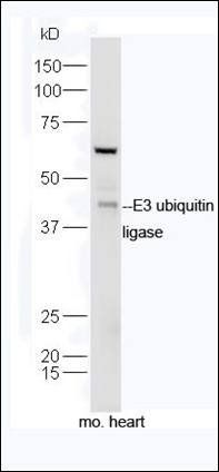 E3 ubiquitin ligase antibody