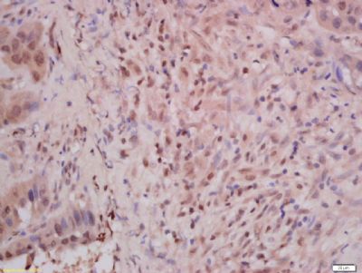Phospho-E Cadherin (Ser838 + Ser840) Rabbit Polyclonal Antibody, Unconjugated