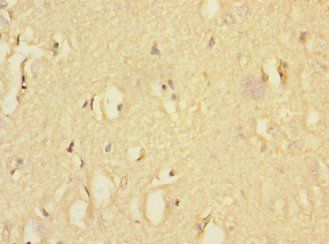EAF2 Antibody