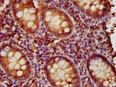 EAF2 Antibody