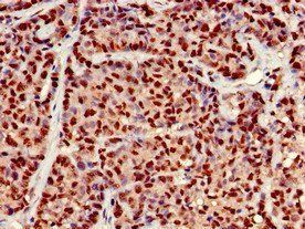 EARS2 Antibody