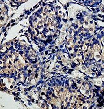 EARS2 Rabbit Polyclonal Antibody