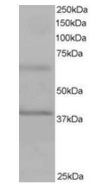 Goat anti-BPOZ / ABTB1 Antibody
