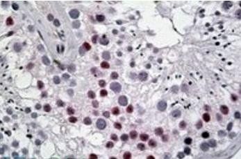 Goat anti-DENTT / CDA1 Antibody