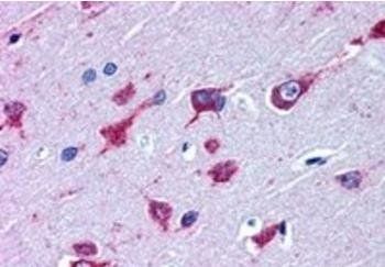 Goat anti-Alsin / ALS2 Antibody