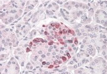 Goat anti-SOCS4 Antibody