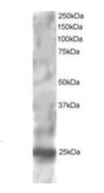 Goat anti-RGS1 / 1R20 Antibody