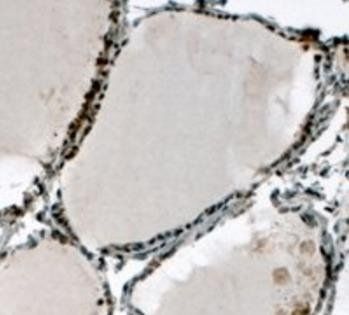 Goat anti-ELF5 Antibody