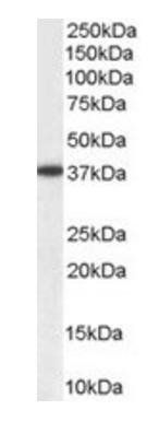 Goat anti-Aldehyde Reductase Antibody