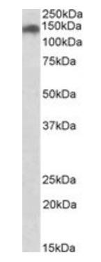 SMC2 antibody