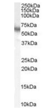 Goat anti-p70S6K / RPS6KB1 Antibody