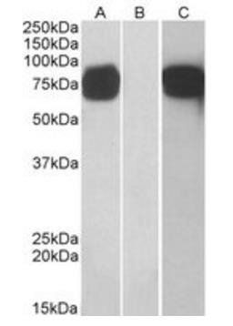 GP73 antibody