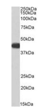 ACADM antibody (Biotin)