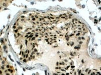 Goat anti-PIR51 / RAD51AP1 Antibody