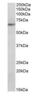 Goat anti-SOCS5 Antibody