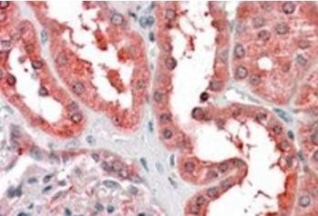 Goat anti-Cyt19 / AS3MT Antibody