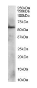 PDIA3 antibody