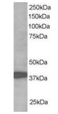 RNF39 antibody