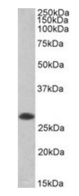 Goat anti-SSP29 / ANP32B, Biotinylated Antibody