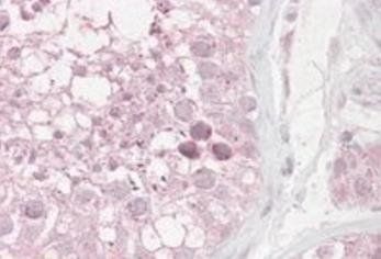 Goat anti-RNF36 / TRIM69 Antibody