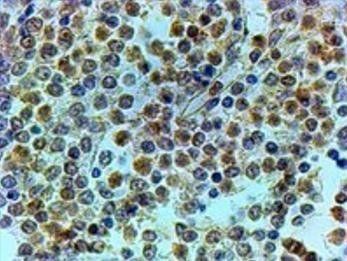 Goat anti-TRIP / TRAIP Antibody