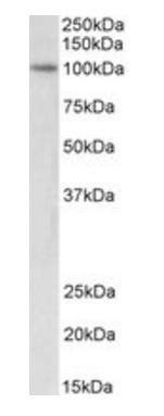 Goat anti-ICBP90 / UHRF1 Antibody