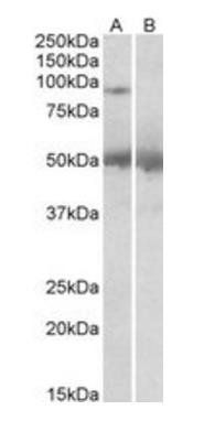 Goat anti-USP6 / TRE2 / TRE17 Antibody