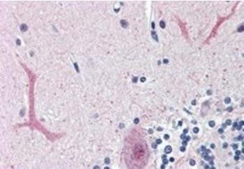 Goat anti-FOXC1 (C Term) Antibody