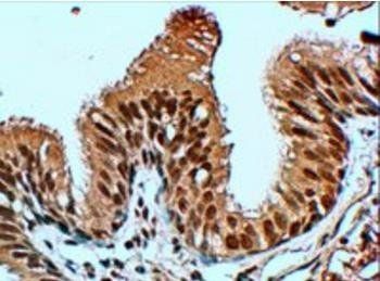 FBXL12 antibody