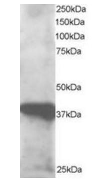 GIPC3 antibody