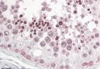 Goat anti-INADL / PATJ Antibody