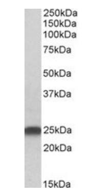 LIN7B antibody