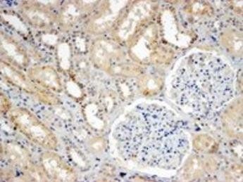 Goat anti-SNX8 Antibody