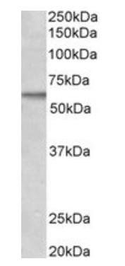 ACVRL1 antibody