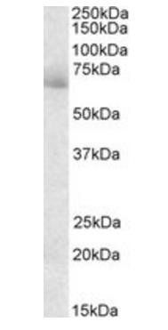 Goat anti-AKAP10 / D-AKAP2 Antibody