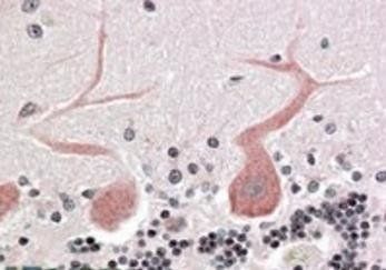 Goat anti-Cdc42-binding kinase alpha Antibody