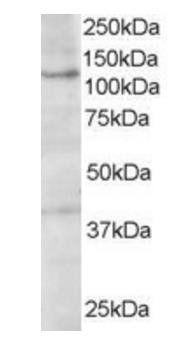 Goat anti-HPS3 / Cocoa Antibody