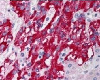 Goat anti-DLC1 (Isoforms 1 and 3) Antibody