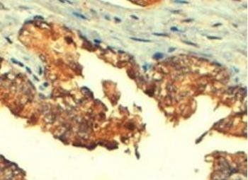Goat anti-ABCC4 / MRP4 Antibody