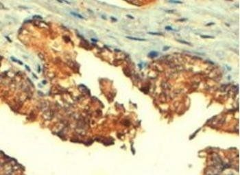 ABCC4 antibody