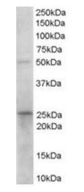 Prostaglandin dehydrogenase 1 antibody