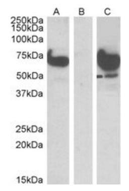 Goat anti-EPM2A (laforin) IP1 Antibody