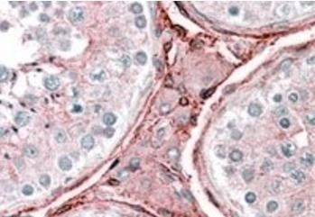 Goat anti-Cytochrome b reductase 1 Antibody