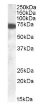 Goat anti-HIP14L / ZDHHC13 Antibody