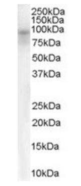 Goat anti-Dipeptidylpeptidase 10 Antibody