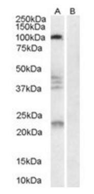 Goat anti-Nogo 66 receptor Antibody
