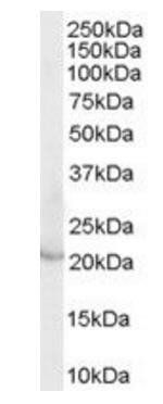 LCN2 antibody