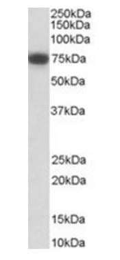 Goat anti-NGFR Antibody