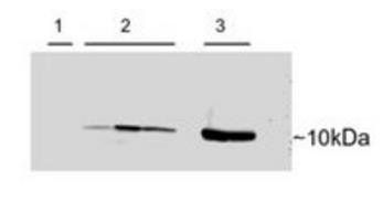 PVALB antibody