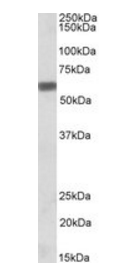 Goat anti-Osteopontin / SPP1 Antibody